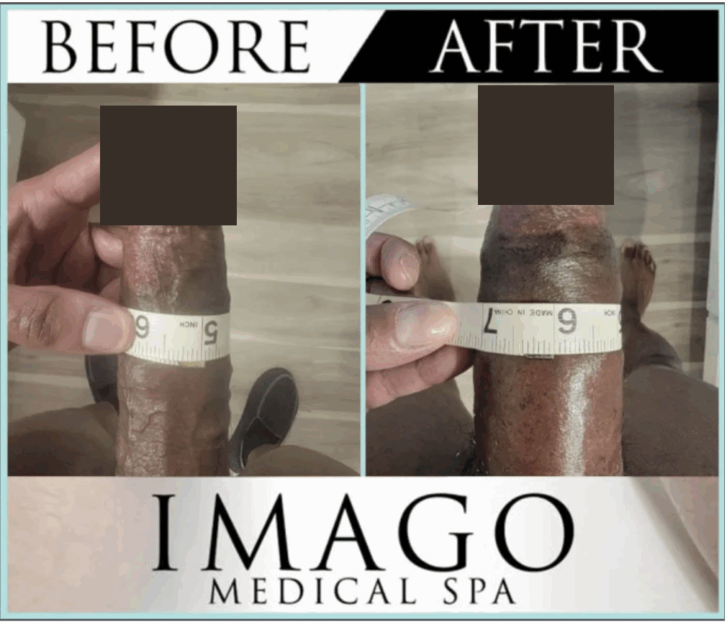 Medical Procedure1