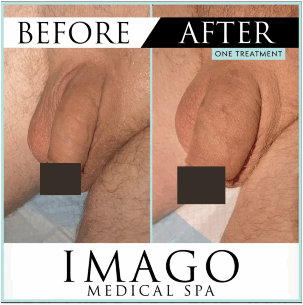 medical procedure