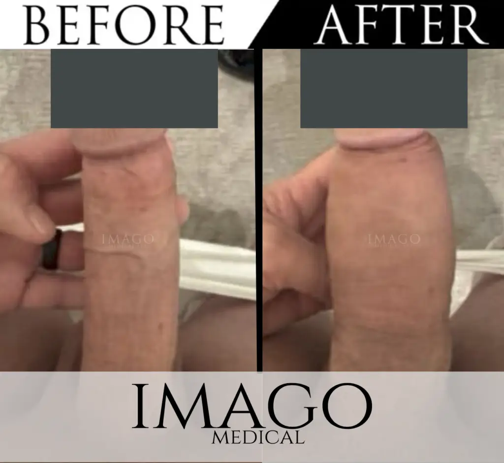 Medical Male Enhancement