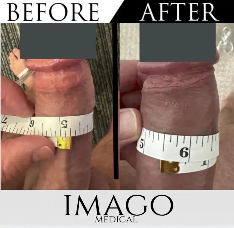 Medical Male Enhancement