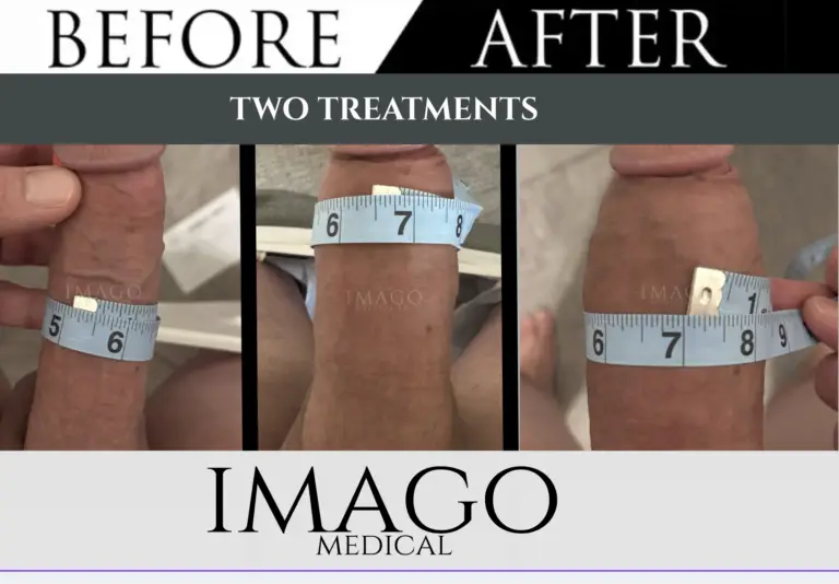Medical Male Enhancement