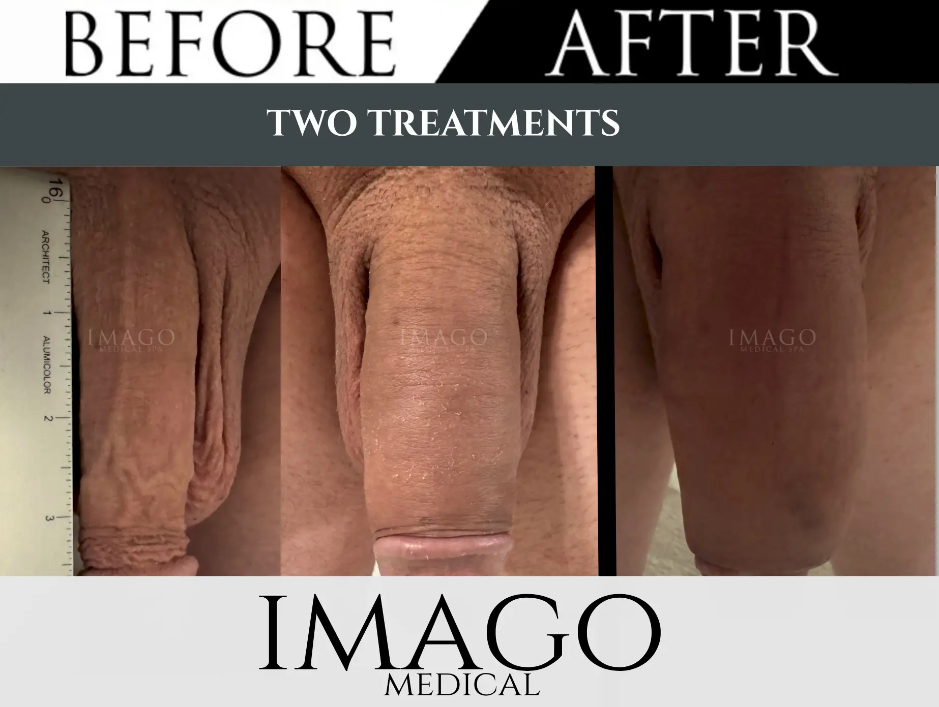 Medical Male Enhancement