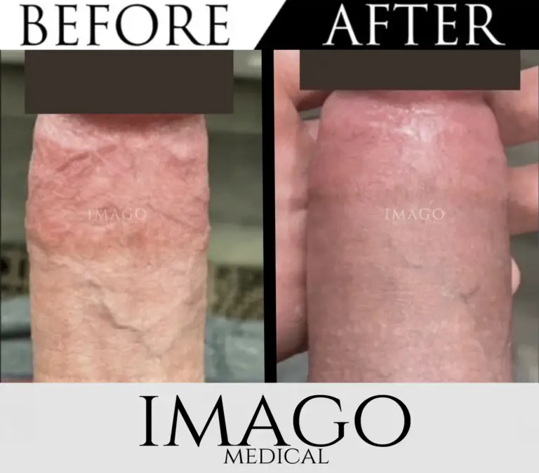 Medical Male Enhancement