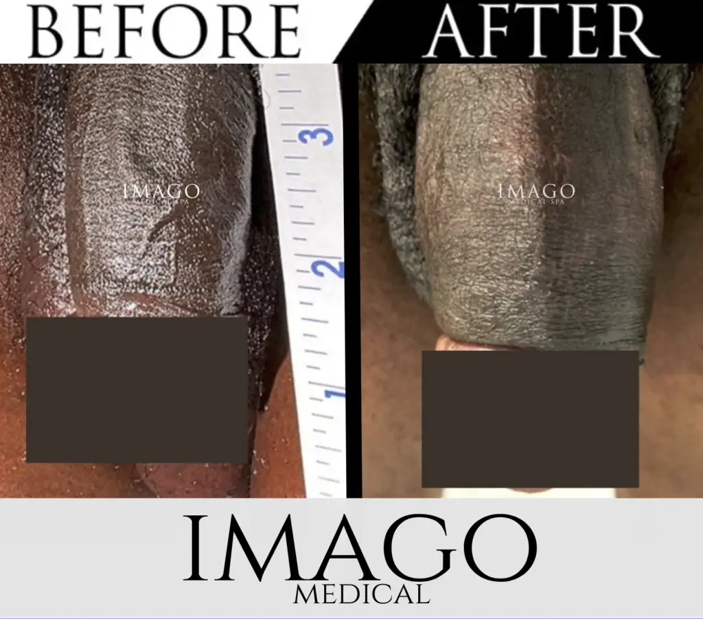 Medical Male Enhancement