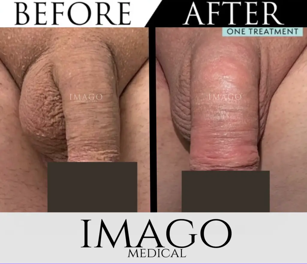Medical Male Enhancement