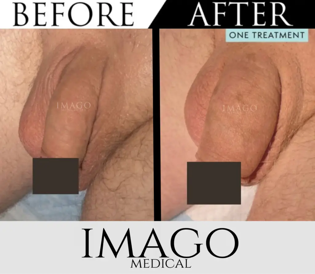 Medical Male Enhancement
